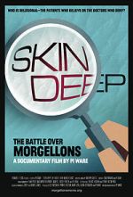 Watch Skin Deep: The Battle Over Morgellons Movies123