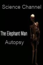 Watch Science Channel Elephant Man Autopsy Movies123