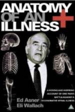 Watch Anatomy of an Illness Movies123