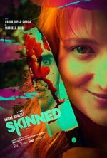 Watch Skinned Movies123