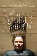 Watch My Beautiful Broken Brain Movies123