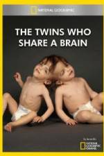 Watch National Geographic The Twins Who Share A Brain Movies123