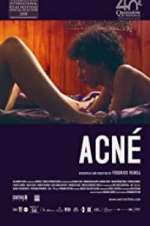 Watch Acné Movies123