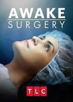 Watch Awake Surgery Movies123